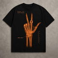 NY Knicks Jalen Brunson Surgery X-Ray Shirt 2026 Jalen Brunson Merch Best Gift For Him