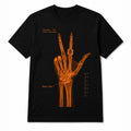 Jalen Brunson Wrist Surgery X-Ray Shirt 2026 NY Knicks Jalen Brunson Merch Basketball Fan Gifts - Merchluma