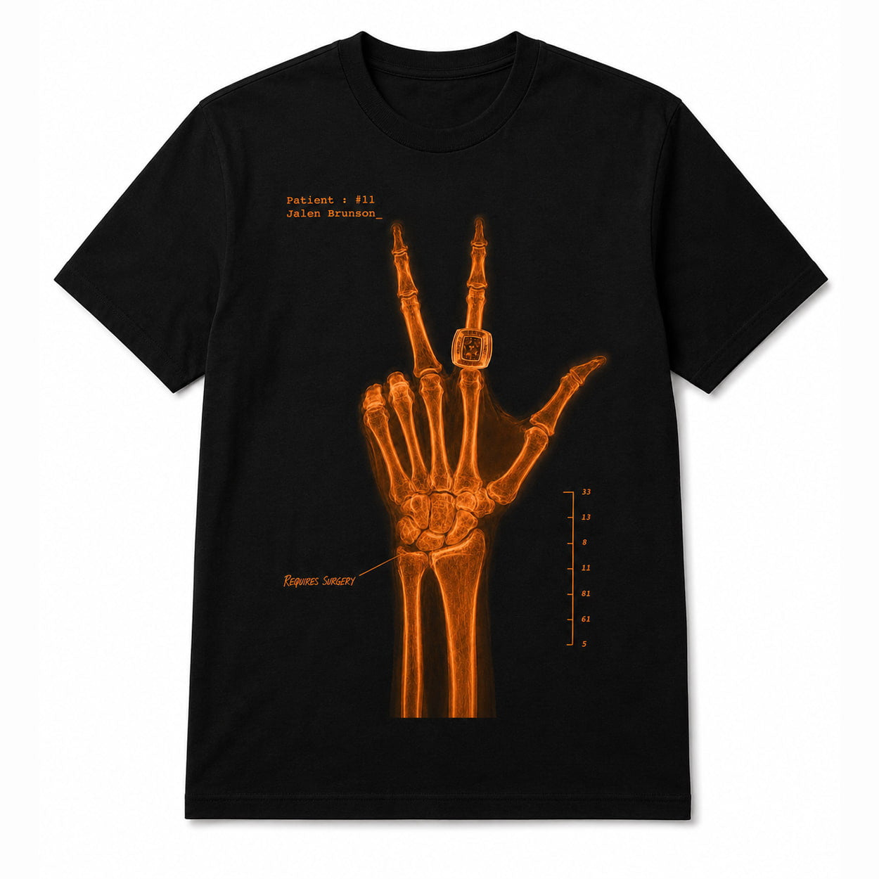 Jalen Brunson Wrist Surgery X-Ray Shirt 2026 NY Knicks Jalen Brunson Merch Basketball Fan Gifts - Merchluma